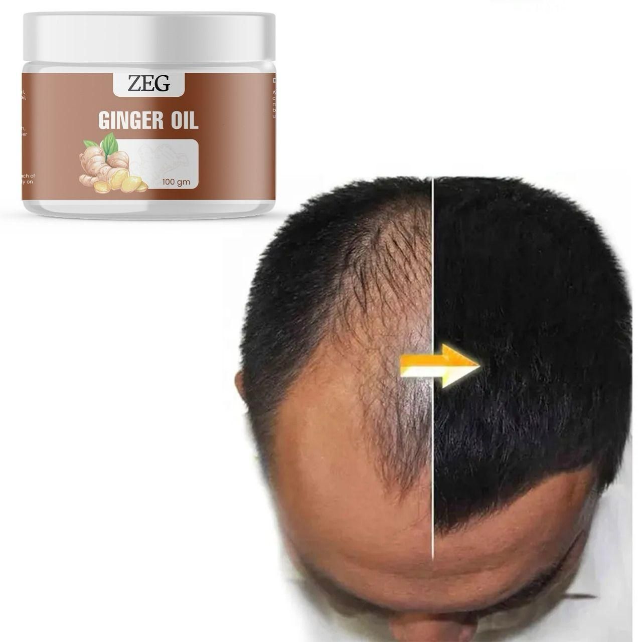 ZEG GINGER OIL 100GM ? 100% Natural Multipurpose Oil for Hair, Skin & Body